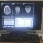 МРТ и отличие от КТ и рентгеновского обследования